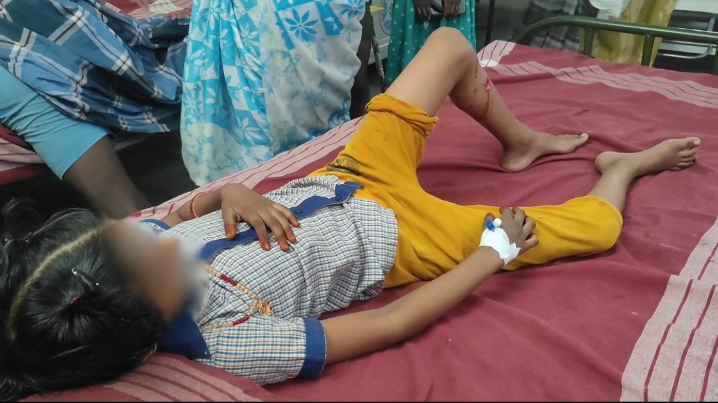 டியூசனுக்கு சென்ற 12 வயது சிறுமியை கடித்துக் குதறிய தெருநாய்