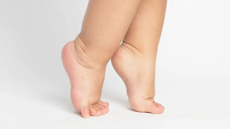 Toe Walking (Tiptoe Walking)