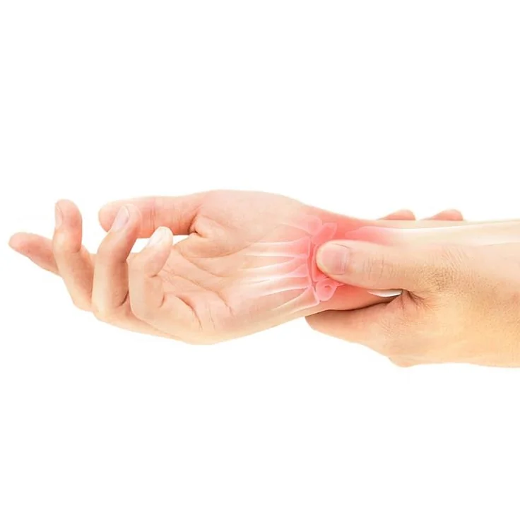 Carpal Tunnel Syndrome: Causes, Symptoms, and Physiotherapy Solutions