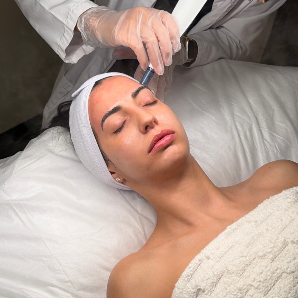 Microneedling with Salmon DNA: 5 Expert Facts