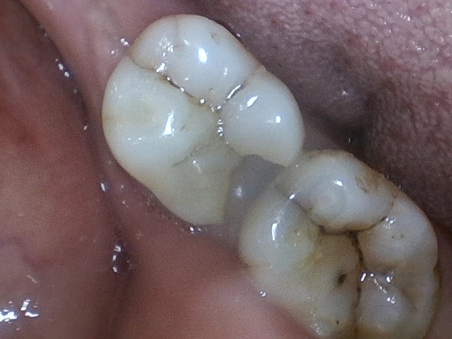 step 1