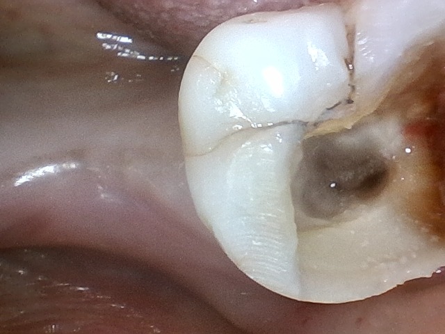 step 2
