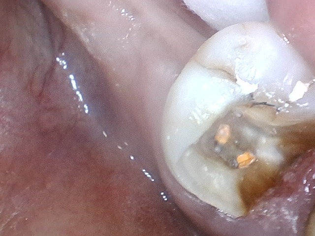 step 3