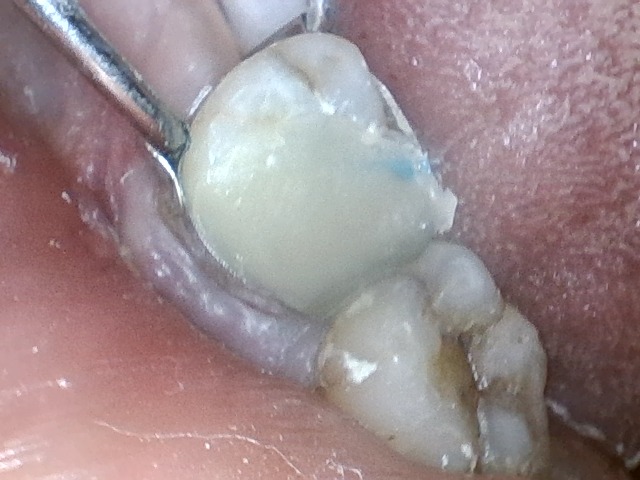 step 2