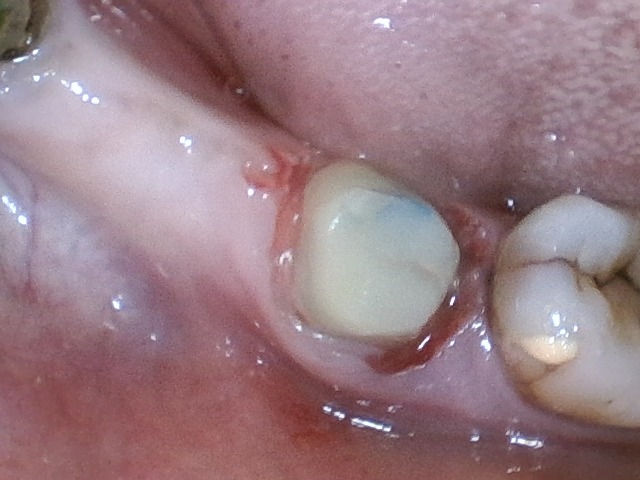 step 3