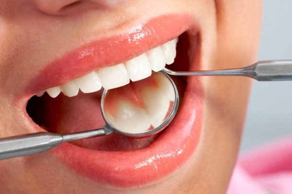 Psychotherapy linked to helping dental anxiety
