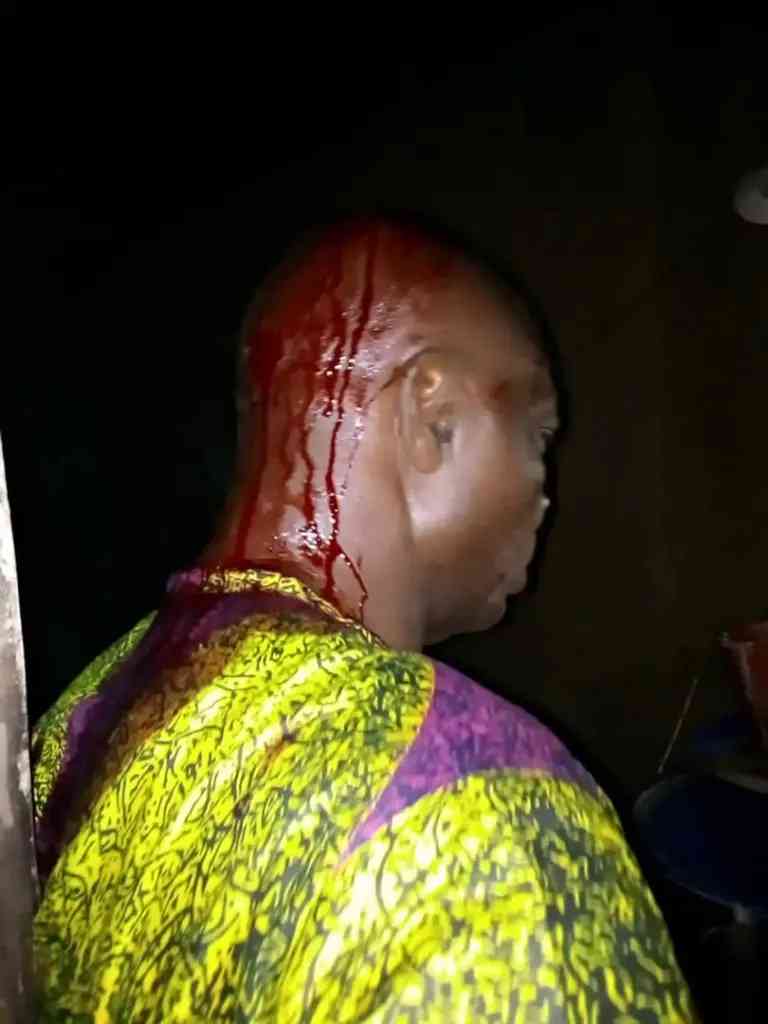 Photos: Scores injured as APC, PDP clash in Oyo