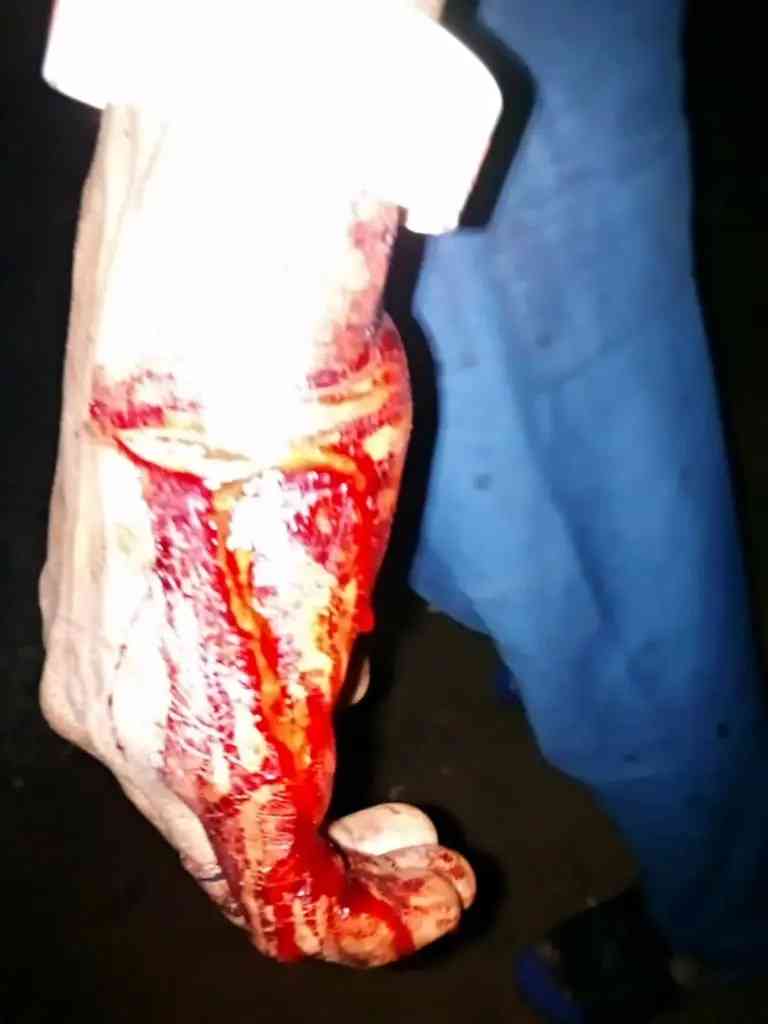 Photos: Scores injured as APC, PDP clash in Oyo