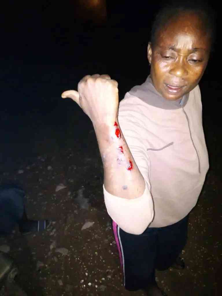 Photos: Scores injured as APC, PDP clash in Oyo