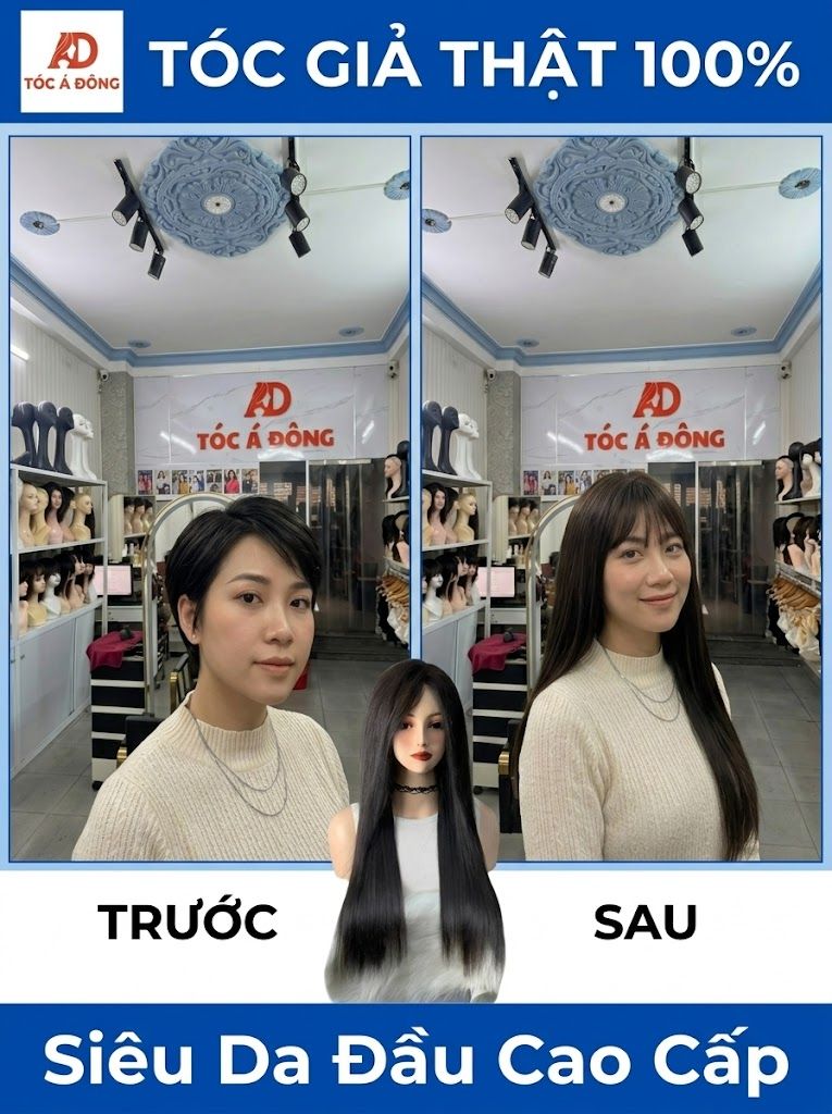 Tóc Giả Y Tế Cao Cấp