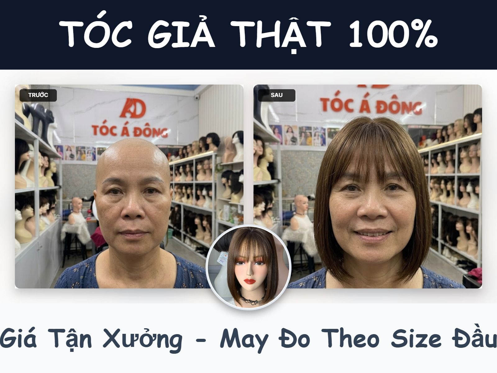 Tóc Á Đông - ung_thu
