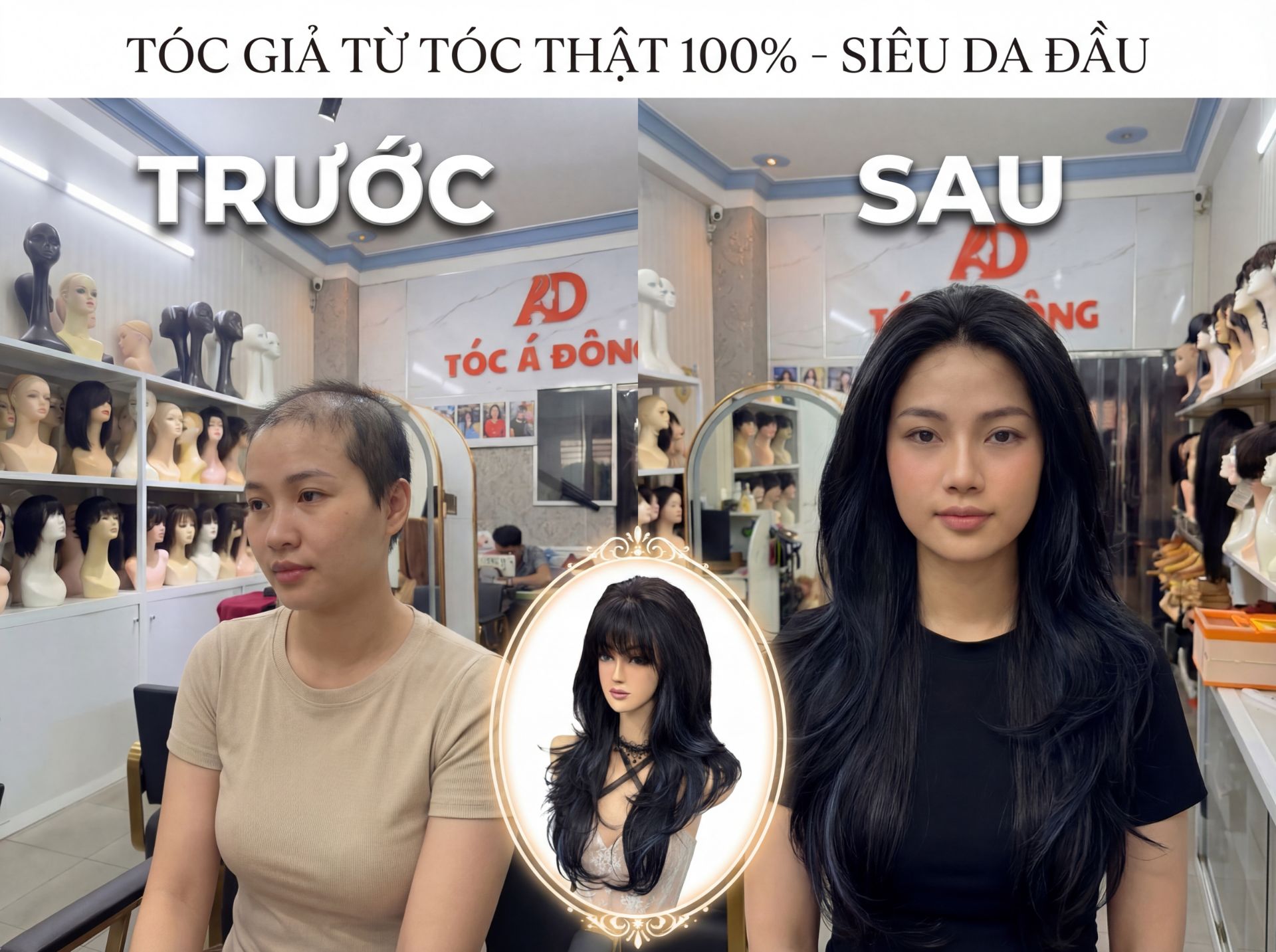Tóc Giả Che Hói - Giải Pháp Hoàn Hảo - Tóc Á Đông