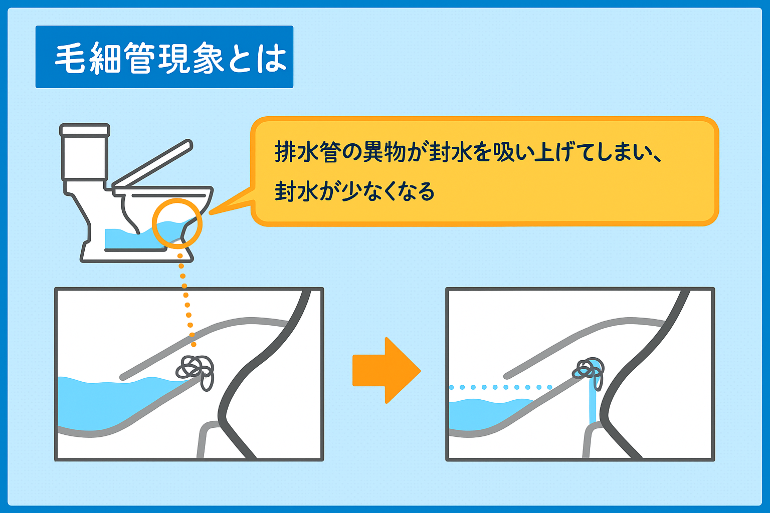 ✅ 原因1｜トイレつまり🚽