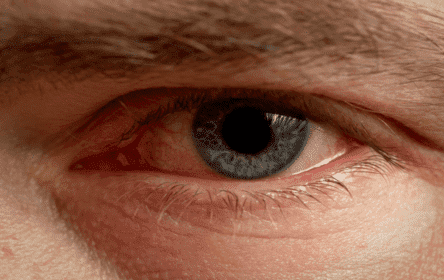 <span style="font-size: 1pt; color: #999999;">Principais Cuidados com os olhos e doenças oculares <span style="color: #ffffff;">Principais Cuidados com os olhos e doenças oculares Principais Cuidados com os olhos e doenças oculares Principais Cuidados com os olhos e doenças oculares</span></span>