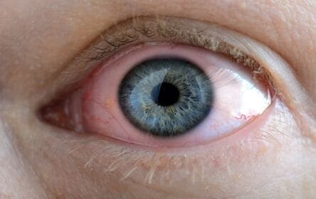 <span style="font-size: 1pt; color: #999999;">Principais Cuidados com os olhos e doenças oculares <span style="color: #ffffff;">Principais Cuidados com os olhos e doenças oculares Principais Cuidados com os olhos e doenças oculares Principais Cuidados com os olhos e doenças oculares</span></span>