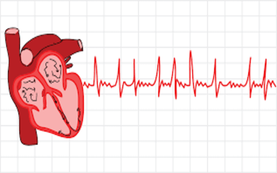 O que é fibrilação AFib atrial e como tratar?