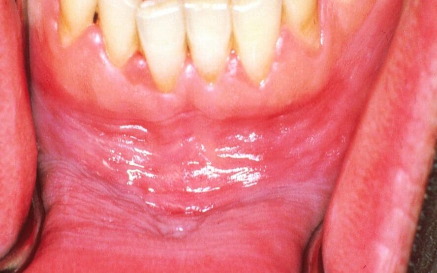 Problemas na boca: ATM, aftas, gengivas dolorosas e muito mais