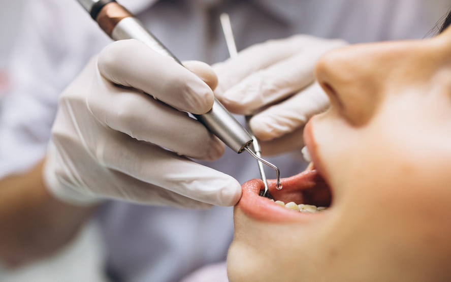 Odontologia Preventiva: Como evitar cáries e muito mais! %contagem (título)% Como reduzir a pressão arterial sem medicamentos