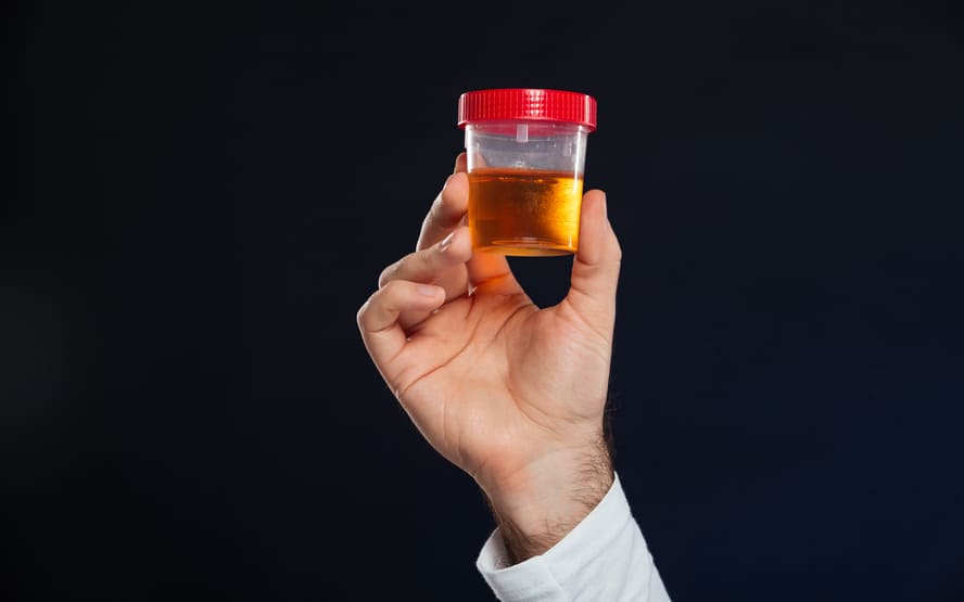 O que é um urologista? %contagem (título)% O que é um urologista?