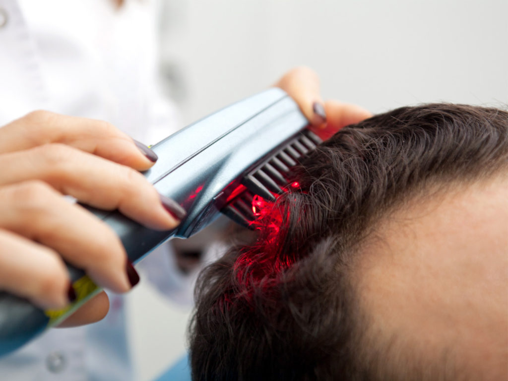 17 tratamentos para perda de cabelo para homens