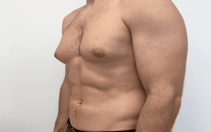 Tudo o que você precisa saber sobre peitos de homem. %contagem (título)% Tudo o que você precisa saber sobre peitos de homem
