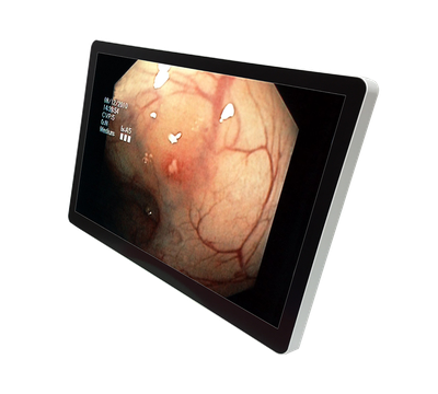 RCC-MM-GMD23G-01R Front