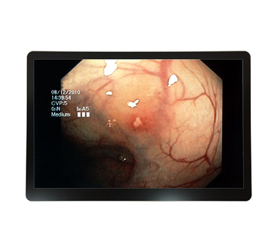 RCC-MM-GMD23G-01R Front