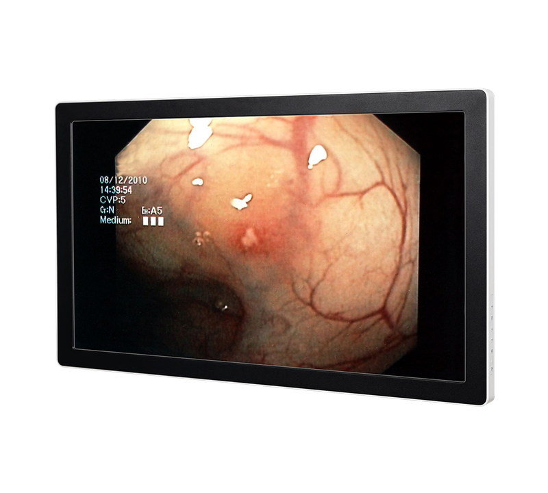 RCC-MM-GMD27G-02R Front