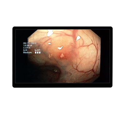 RCC-MM-GMD32G-02R Front