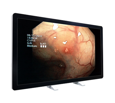 RCC-MM-GMD55G-01R Front