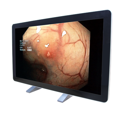 RCC-MM-GMD55G-01R Front