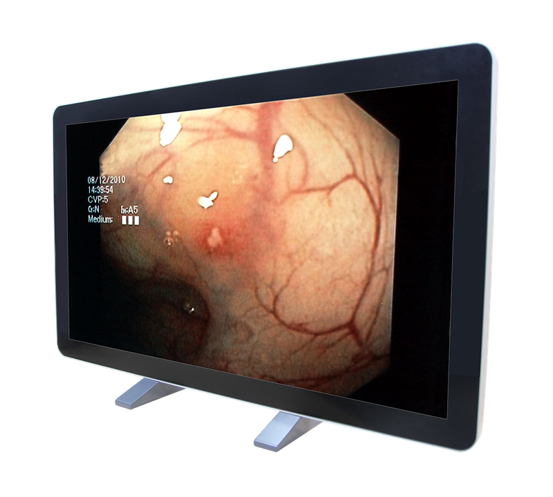 RCC-MM-GMD55G-01R Front