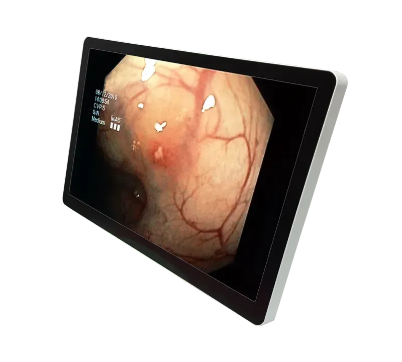RCC-MM-GMD23G-01R Front