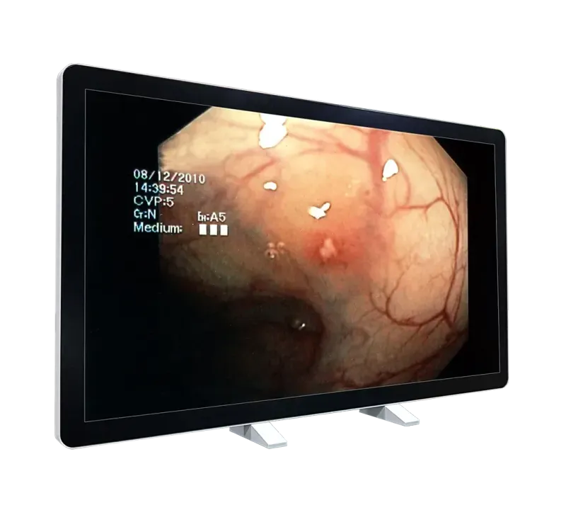 RCC-MM-GMD55G-01R Front