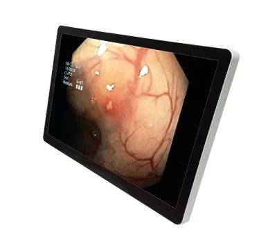 RCC-MS-GMD23GT, Image 1