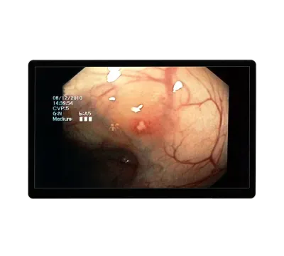 RCC-MS-GMD32GT, Image 2