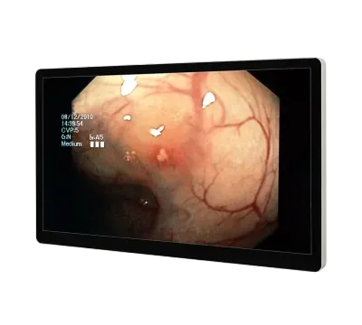 RCC-MS-GMD32GT, Image 1