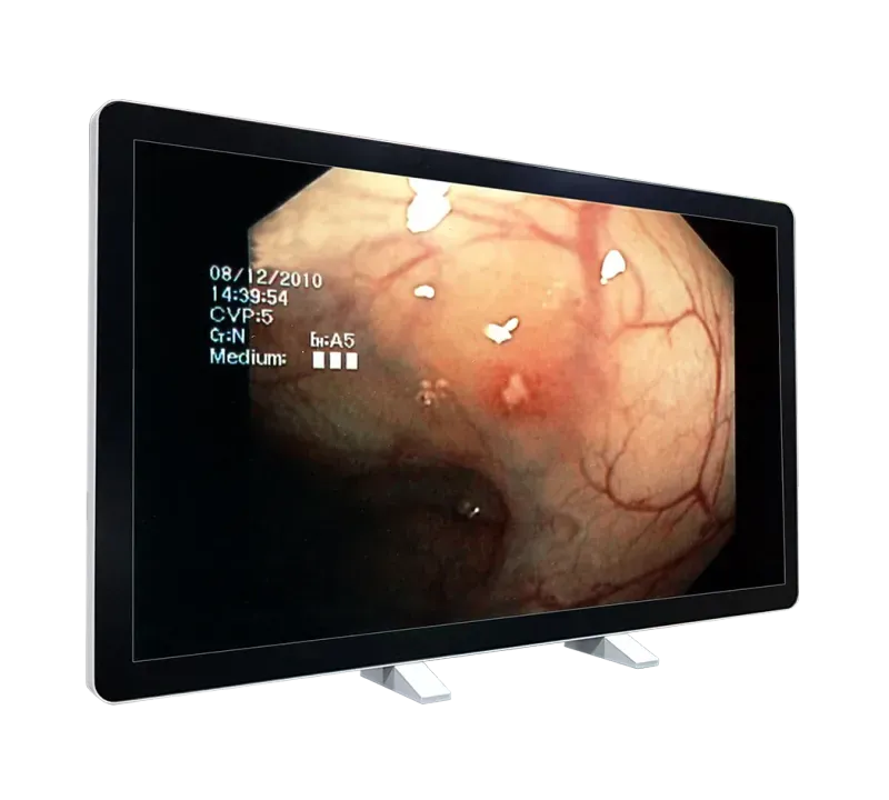 RCC-MS-GMD55GT Front