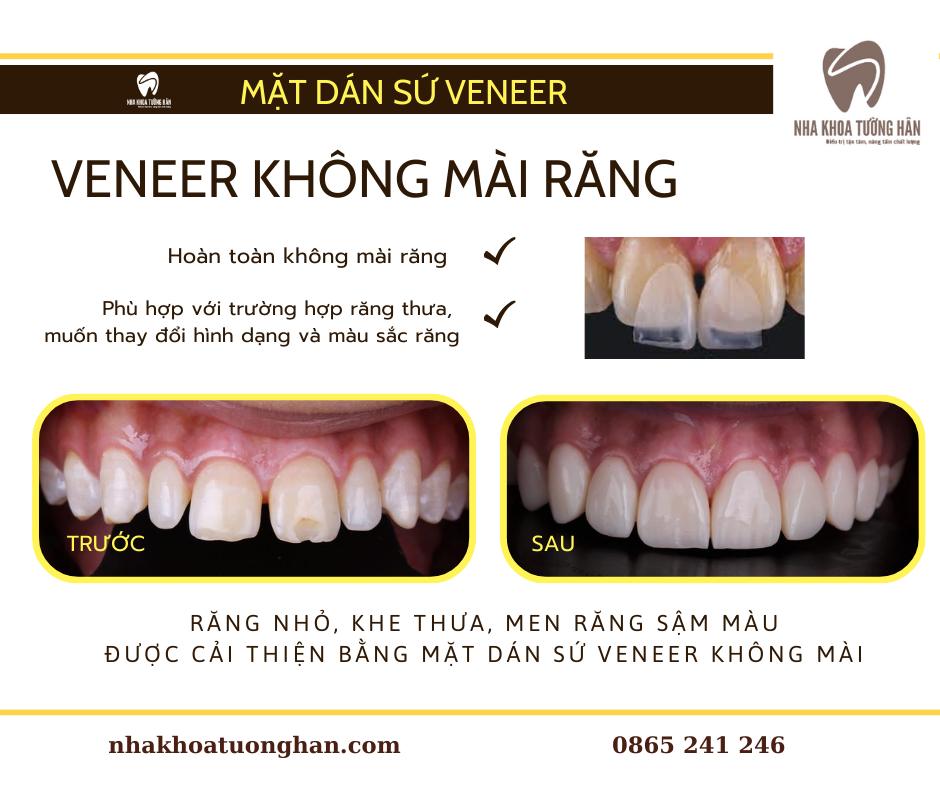 Nha khoa thẩm mỹ