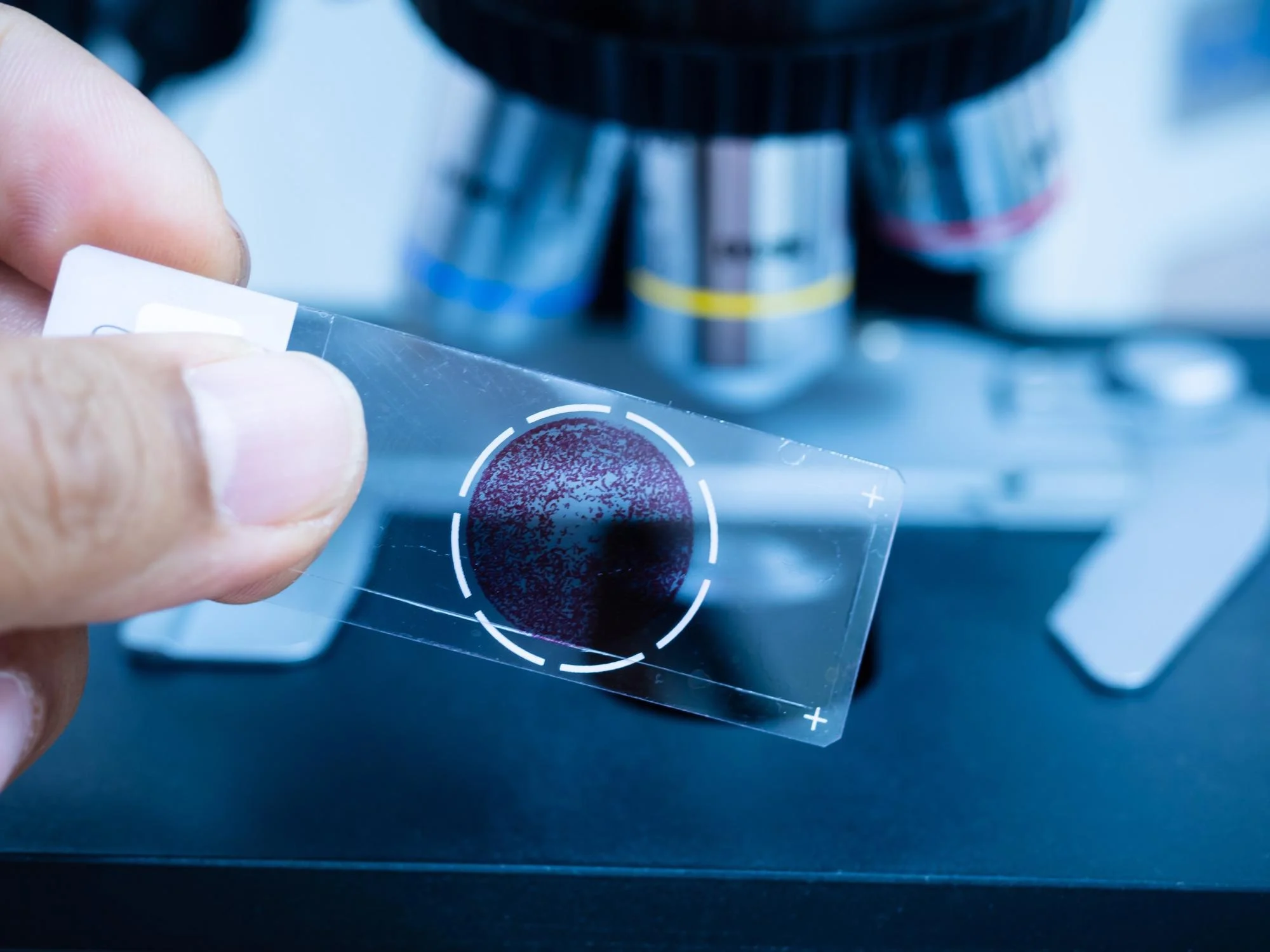 Patoloji: TUS'un Gizli Kahramanı