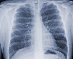 Logo de Hostal las cachas grandes