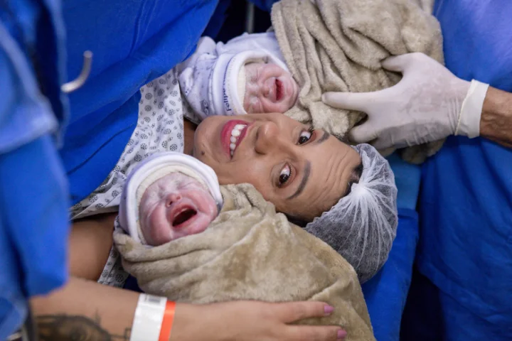 Foto de Parto Julia e Alice - Relato da família