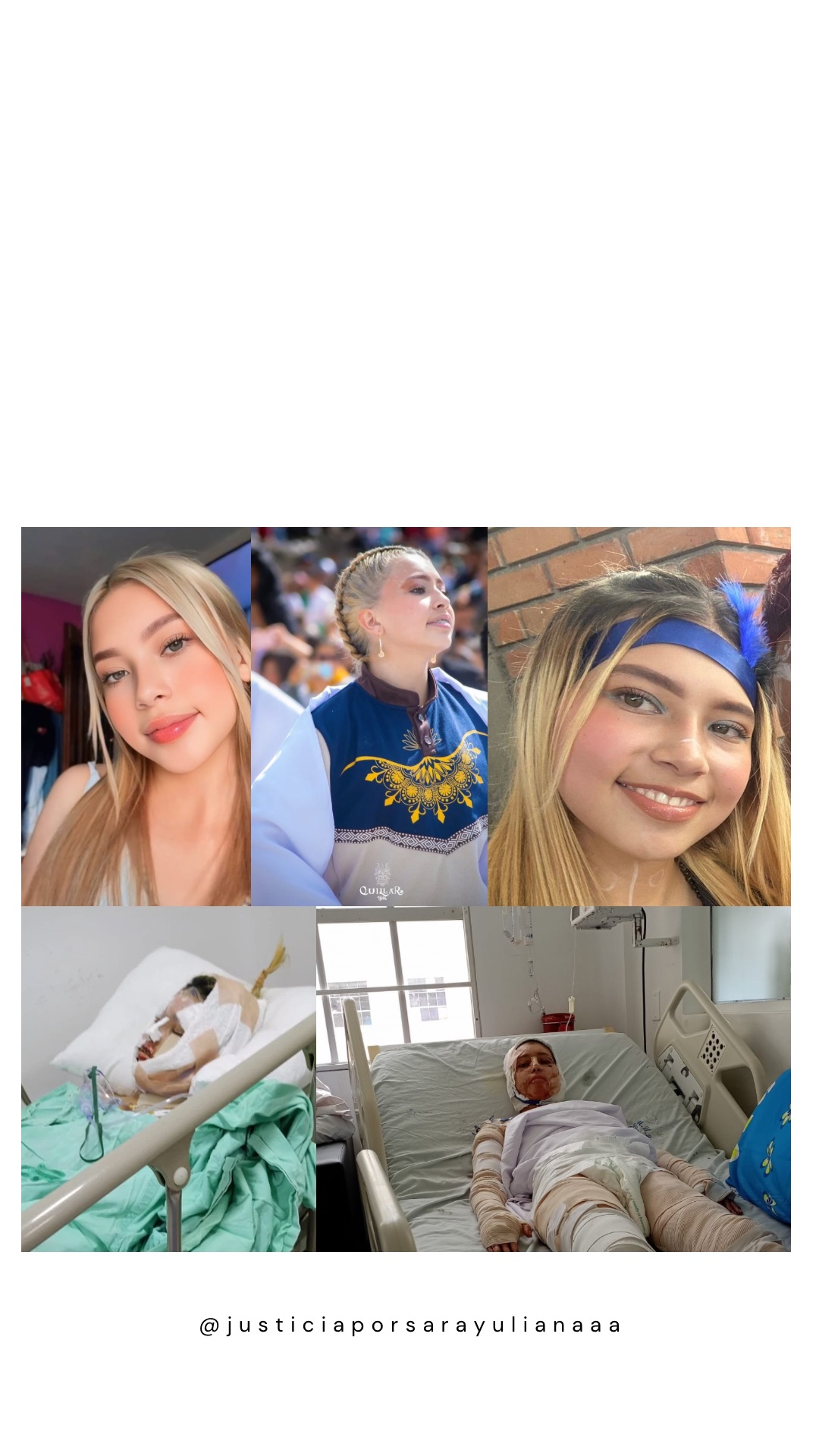 Ayudemos a que sarita pueda adquirir sus tratamientos y vuelva a sonreír