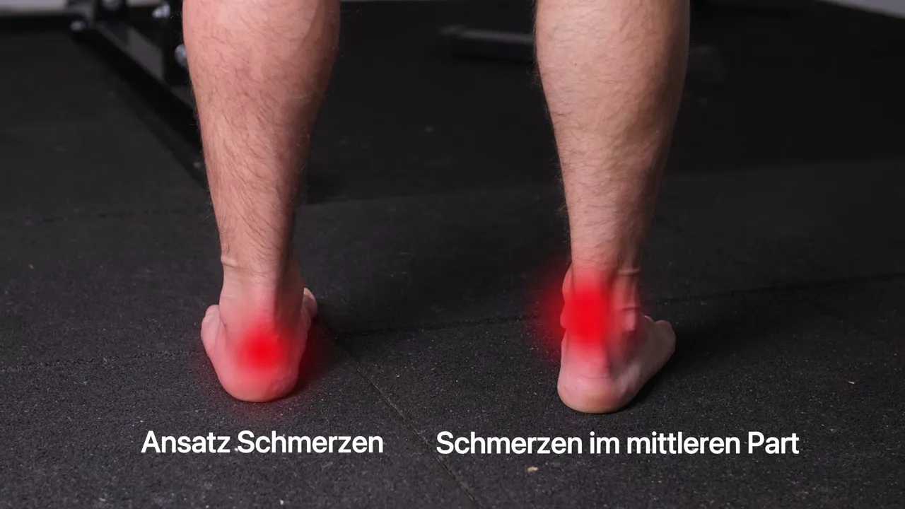 Grafik: Fehler Nr. 1 – Sehne immer zu dehnen oder massieren