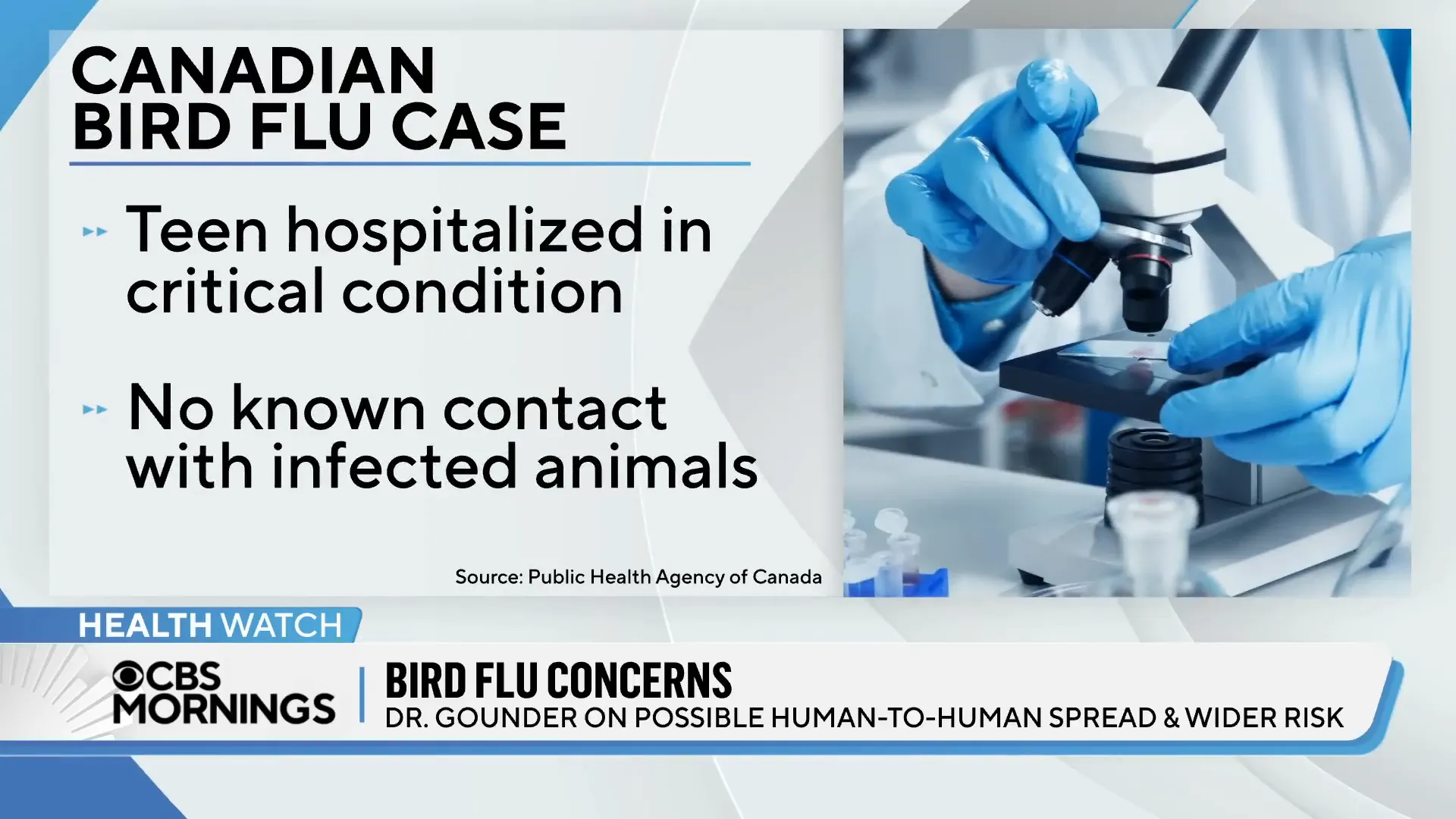 Teen hospitalized with bird flu in Canada