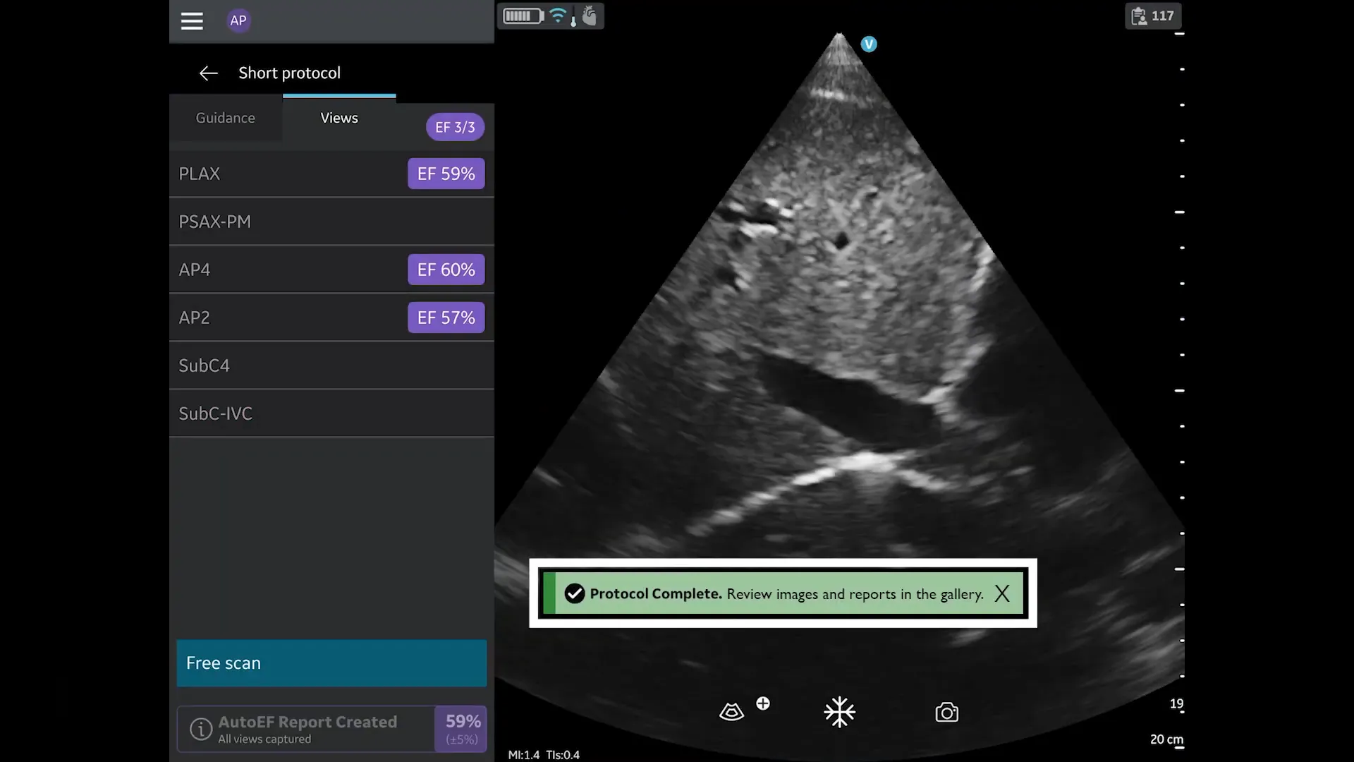 Protokoll abgeschlossen: Free Scan Modus aktiv