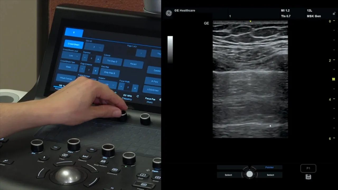Erste Tiefeinstellung 6 cm, Anpassung empfohlen
