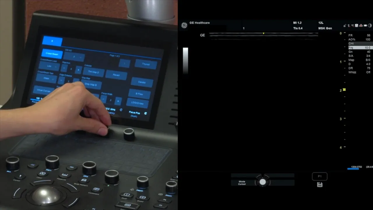 Fokusposition wird über der Pleuralinie eingestellt