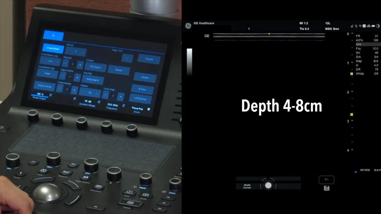 Tiefeinstellung zwischen 4 und 8 Zentimetern, bevorzugt 4 cm