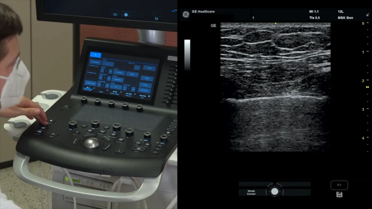 Feinjustierung des Gain nach Bildoptimierung